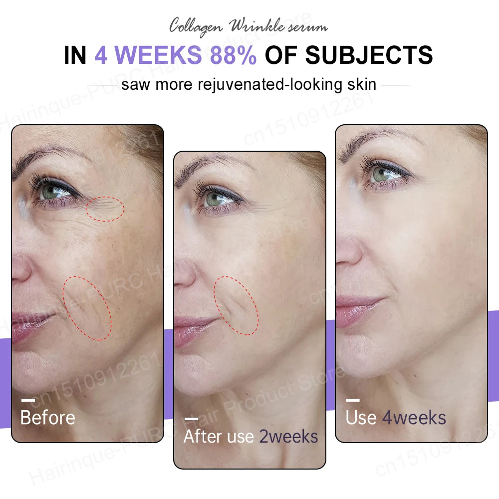 Collagen Face Serum Wrinkle Removal Hyaluronic Acid anti Aging Fine Lines Lifting Niacinamide Brighten Serum Skin Care Joypretty