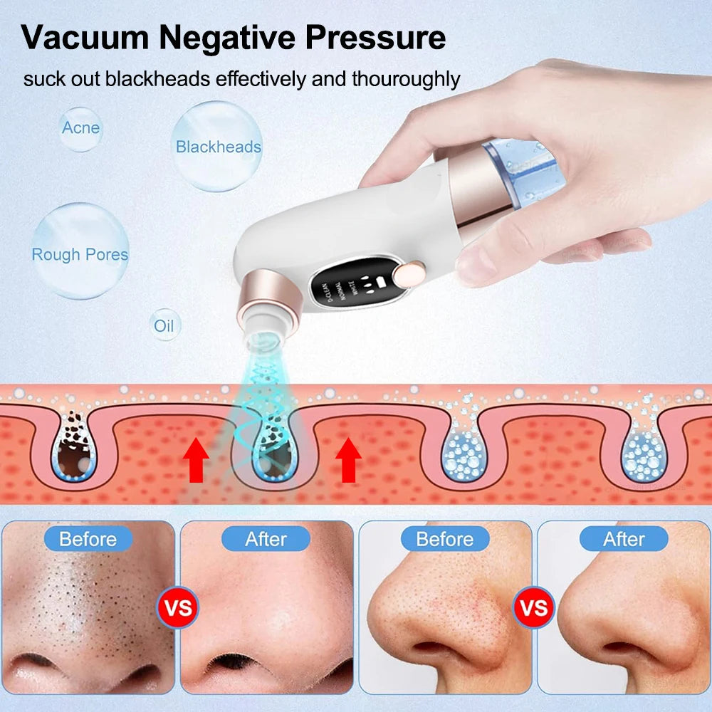 Blackhead Remover Pore Vacuum Cleaner Multifunctional Cleaning Instrument Small Bubble Facial Cleasing Machine Beauty Device